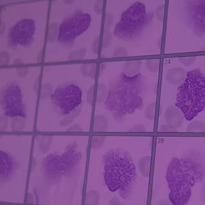 https://somosqualys.com.br/wp-content/uploads/2021/09/laborsys-poa-linhas-comercializadas-hematologia.jpg